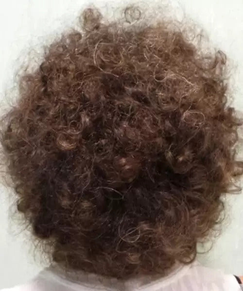 curly hair after lasercap