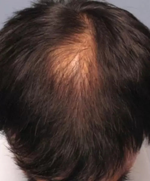 short black hair after patient