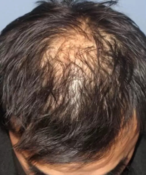man with short black hair before
