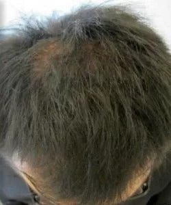 after short black hair