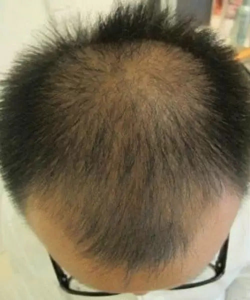 before of short black hair